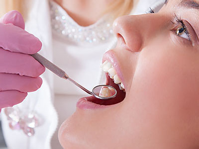 A woman receiving dental care with a drill being used on her teeth by a professional in a dental office setting.