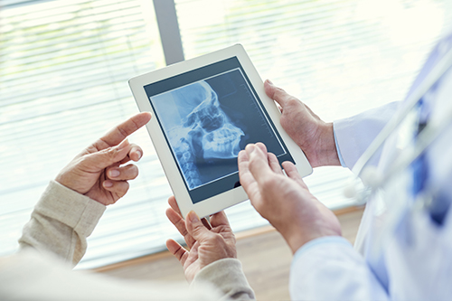 A tablet displaying an X-ray is being held by two people, who appear to be medical professionals, with a third person pointing at the X-ray on the tablet screen.