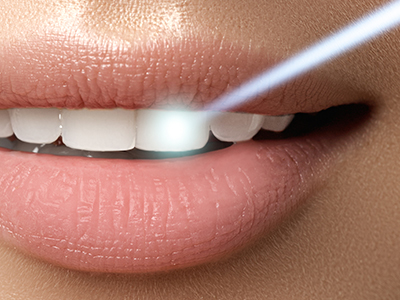 The image shows a close-up of a person s face with lips partially open, displaying teeth, against a blurred background.